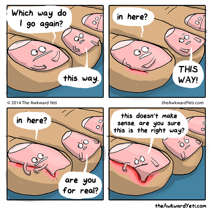 IngrownNail1 Ingrown Nail Surgery