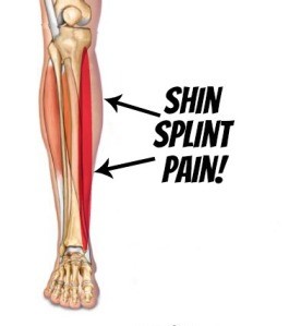shin-splint-pain Shin Splints Stretching and Strenghthening