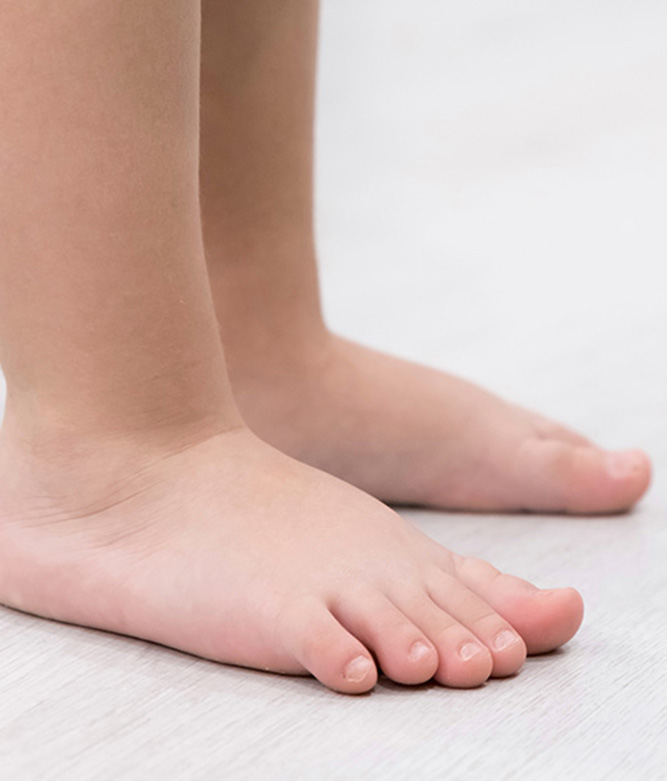Flat-Feet Kids/Paediatric Feet