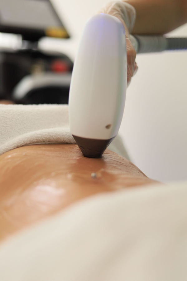 Laser-Therapy-on-an-elbow-800x600-1 Class 4 Laser Therapy in Mount Lawley